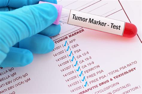 tumor marker test dropped 100 points since first chemo|cancer marker levels.